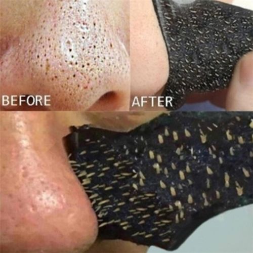 Nose Blackhead Remover Strips – Deep Pore Cleansing Charcoal Strips